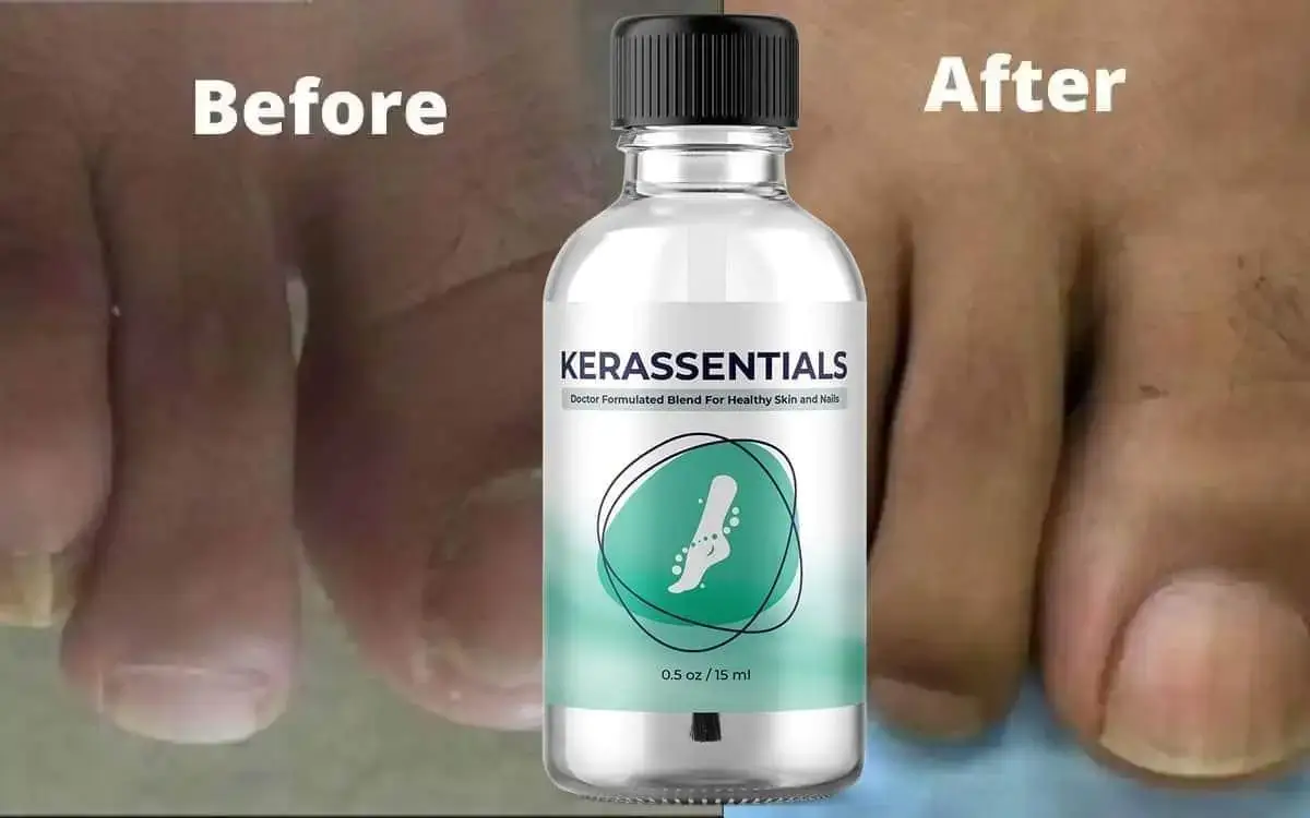 Kerassentials Healthy Nails